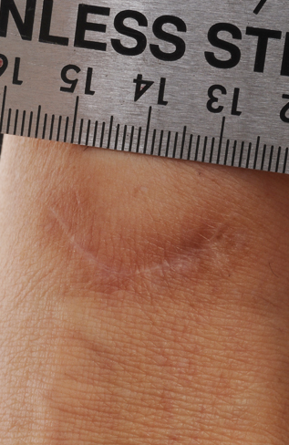 Personal Injury Photography
